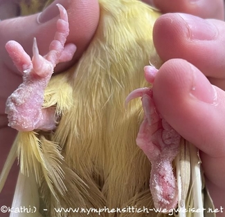 Grabmilben unter den Füßen