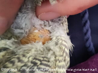 Lipom - entzündet und punktiert