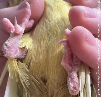 Grabmilben unter den Füßen